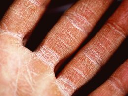 persons palm in close up photography